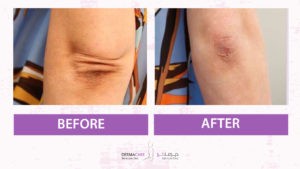 علاجات اليدين والذراعين