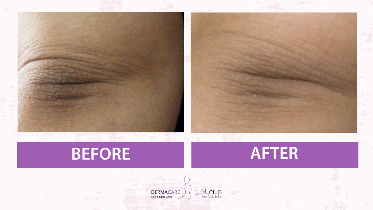 علاجات اليدين والذراعين