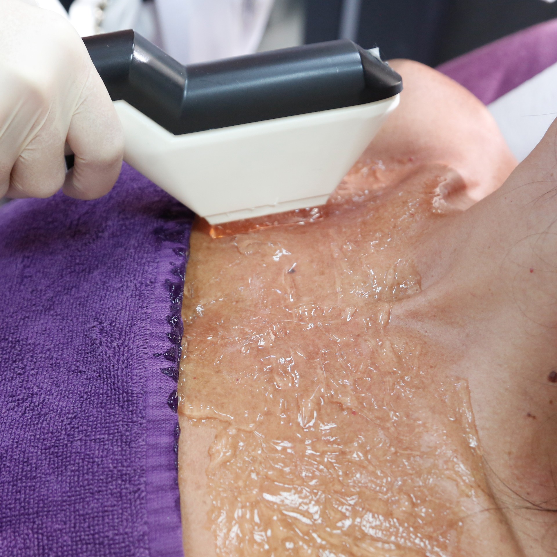 Décolletage (upper chest area) - Image 2