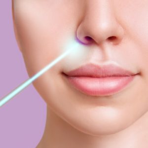 Intra-oral laser - face sculpting