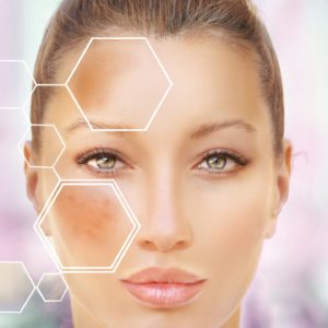 Dark spots treatments