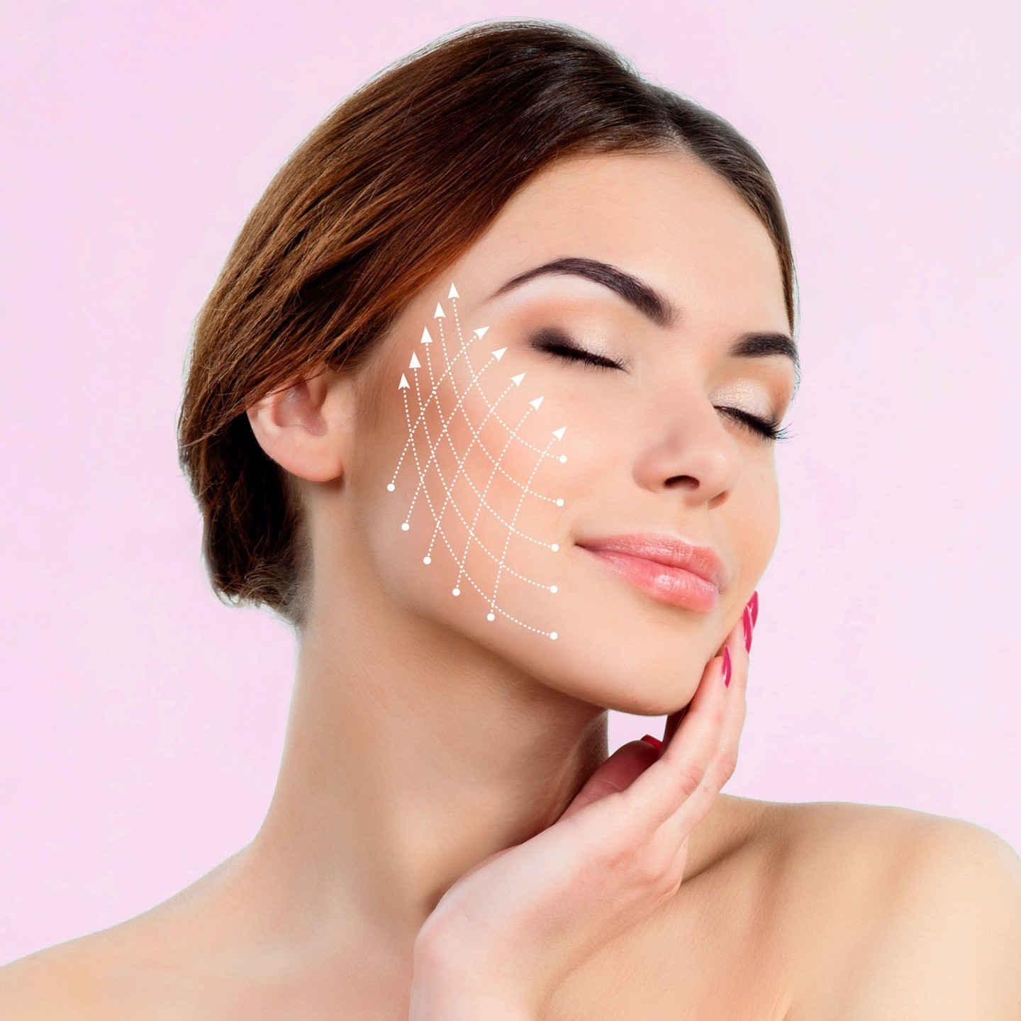 Thread lift - face sculpting