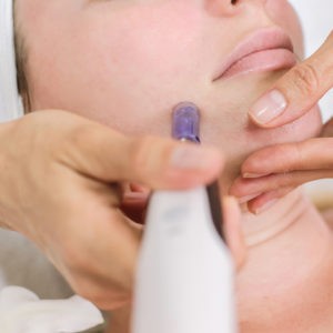 DermaPen - Skin Rejuvenation