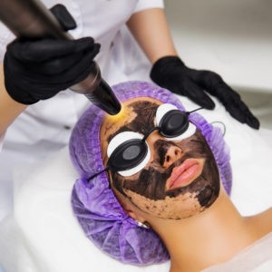 Carbon laser facial