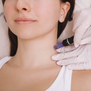 DermaPen - Neck Tightening