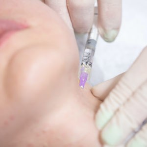 Horizontal neck lines