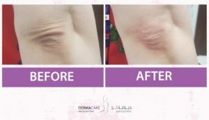 علاجات اليدين والذراعين